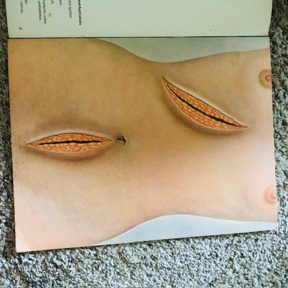 Vintage Medical Ephemera -Ethicon The Abdomen- Layers of Abdomen - Stitches 1968 - Picture 4 of 14